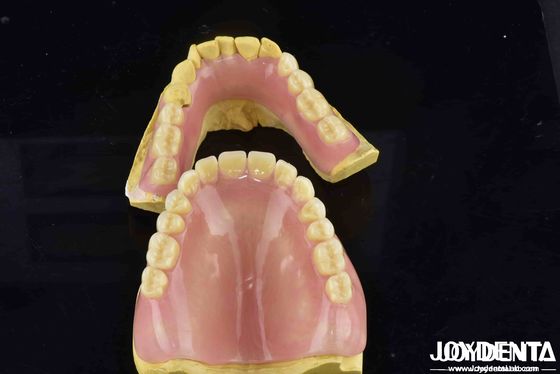 Unleash Potential Of Your Dental Practice Acrylic Denture Finish With Diverse And Lightweight Property