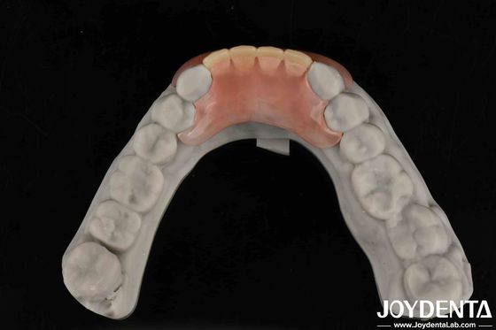Take Your Dental Practice To Next Level Flexible Denture Finish With Natural Tooth Morphology And Personalized Customization