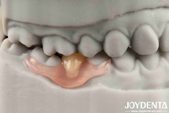 Flexible Denture Finish Personalized Customization and Advanced Tooth Arrangement Technology for Customized Needs