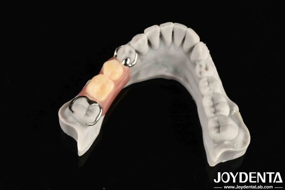 Stable Oral Structure For Dental Professionals In Firmly Connect The Row Teeth