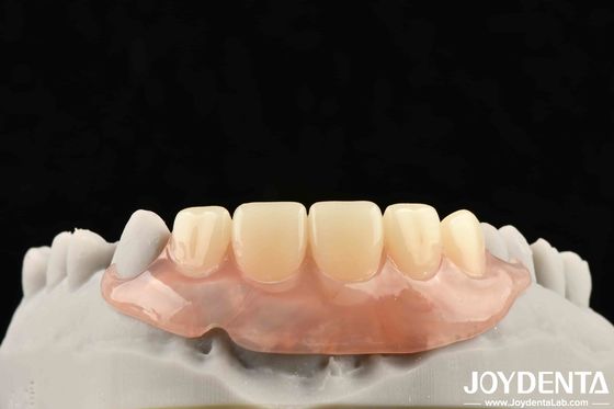 Elaborate Technology Framework Set Up Teeth Finish For Stable Oral Structure In Dental Technology Apply To Dental
