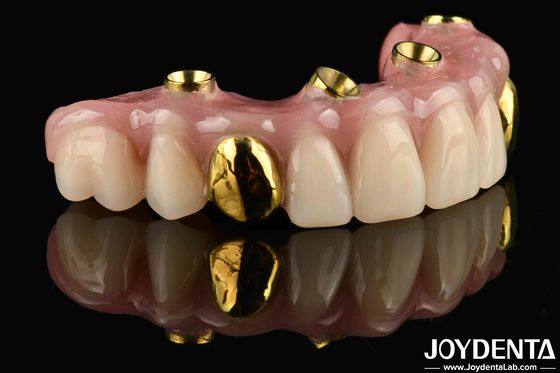 50ml Dentwre From United States Your Ultimate Solution Ti-Bar Acrylic Teeth Finish For Dental Treatment