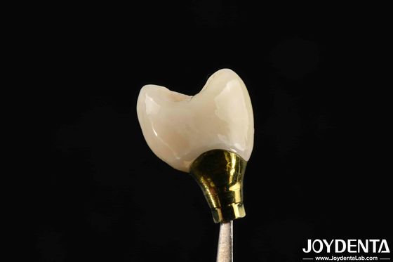 Various Sizes Implant Crown And Bridge For Strong Dental Implants Compatibility