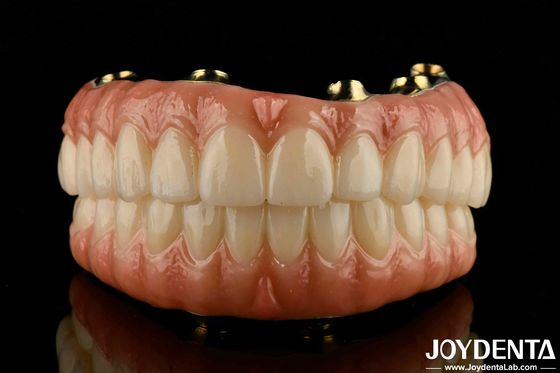 Natural Teeth And Gums Compatible Ti-Bar Zirconia Hybrid Bridge With High Biocompatibility