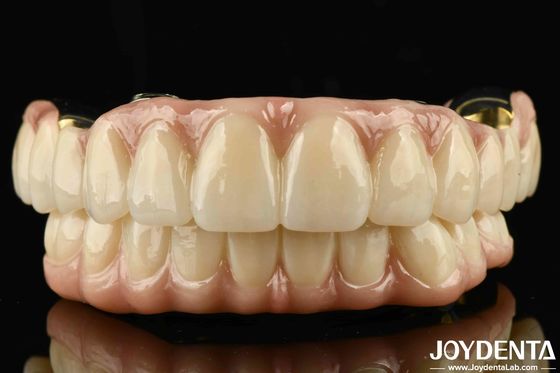 Excellent Strength Ti-Bar Zirconia Hybrid Bridge For Natural Teeth And Gums Compatibility