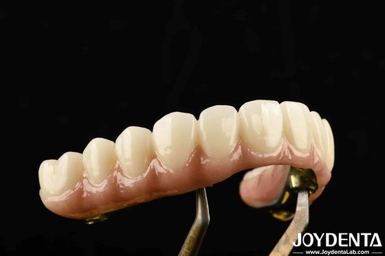 Durable Ti-Bar Zirconia Hybrid Bridge Made Of Titanium And Zirconia Materials For Heavy Us