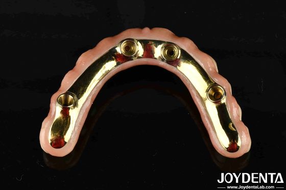 Comfortable To Wear Ti-Bar Restores Chewing Function Essential Ti-Bar Zirconia Hybrid Bridge For B2B Transactions