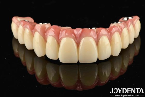 Low Density Light Weight Comfortable To Wear Titanium Malong Hybrid Bridge For Long-Lasting Performance