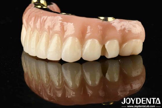 Transform Your Dental Restoration With Ti-Bar Zirconia Hybrid Bridge Durable And Long-Lasting