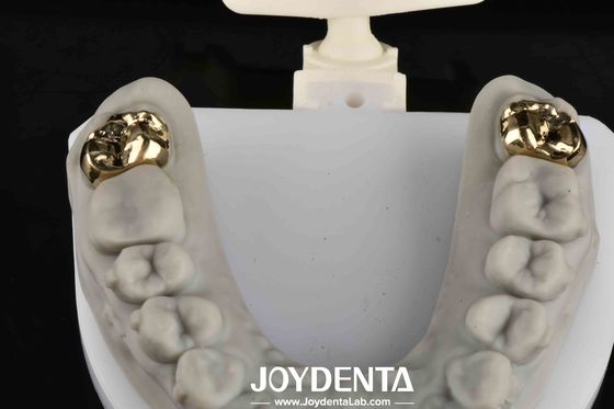 Oral Rehabilitation With Dental Achieve Brighter And Healthier Smile