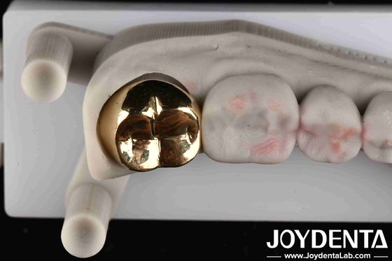 Professional Grade Gold Crown For Dental Oral Clinical Application Yes Abrasive Resistance