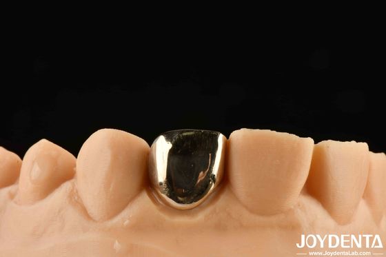 Experience Oral Rehabilitation Like Never Before With Gold Crown Wax Casting