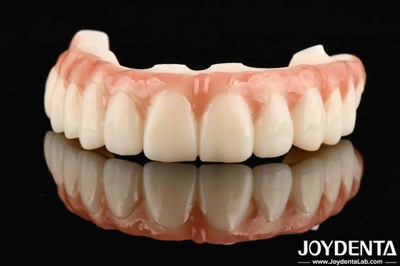 Scratch-resistant Surface For Long-lasting Restorations Dental M75 Durable Restorations