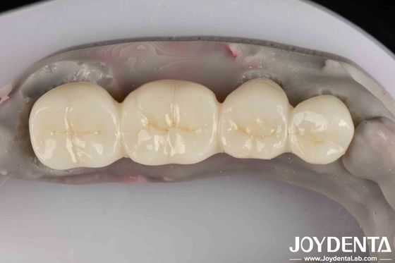 Excellent White Product Full Zirconia With High Resistance To Corrosion Capability