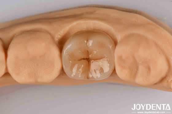High Precision Applications Full Zirconia With High Resistance To Thermal Shock