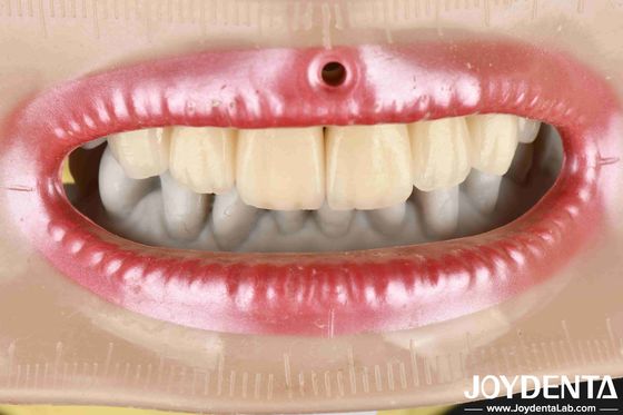 Layered Zirconia High Aesthetics Excellent Biocompatibility Sintering Temperature 1350-1450°C For Advanced Materials