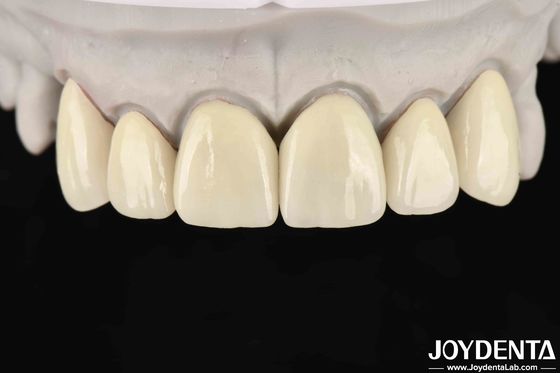 6.0-6.1 G/cm3 Density Layered Zirconia For High Translucency In CAD / CAM Milling