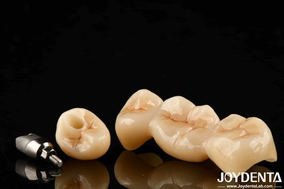 Multilayer Full Zirconia High Resistance To Cracking And Durability For Long-Lasting Dental Restorations