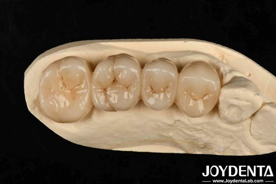 Multilayer Full Zirconia White Style With Layers High Translucency High Resistance To Cracking