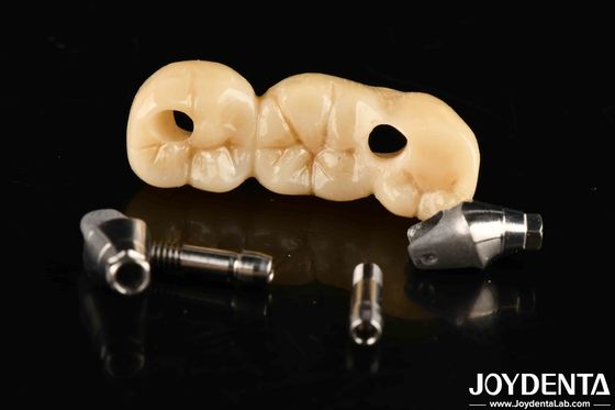 Implant Crown And Bridge With Customizable Design High Durability Accurate Fit