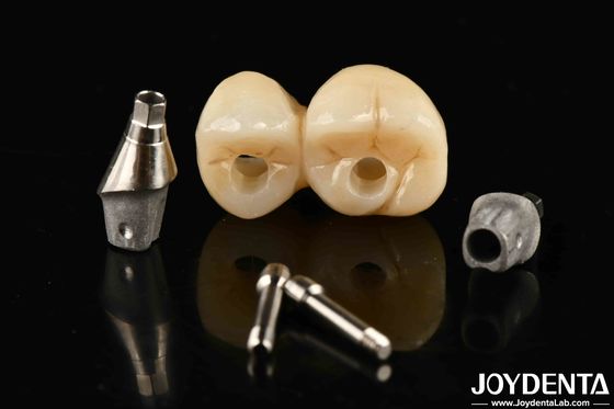 Accurate Fit Implant-Supported Crown Bridge System With Resistance To Stains And Discoloration