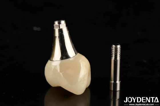 Biocompatible Dental Implant Crown And Bridge Aesthetically Pleasing For Safe Oral