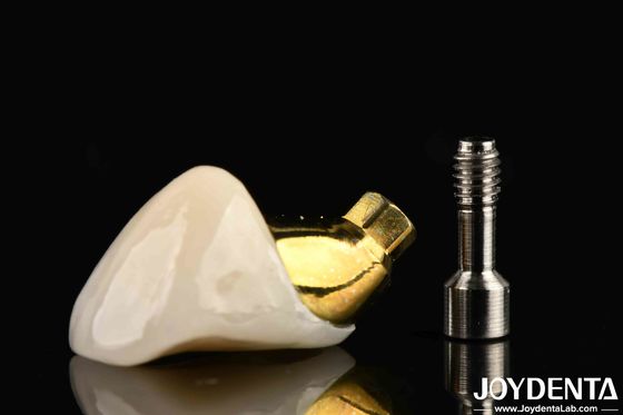 Long-Lasting Implant Crown And Bridge For Restoring Missing Teeth Suitable For Dental Implants