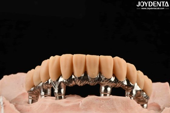 Yellow Resin Temporary Teeth Smooth Surface Treatment Precise And Stable