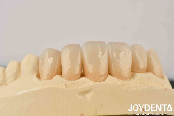 Let The Light Dance In Zirconia Building The Transparency Of Enamel And The Warmth Of Dentin