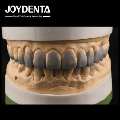 Temporary Use Diagnostic Wax Ups Smooth Texture Teeth Wax Up Custom