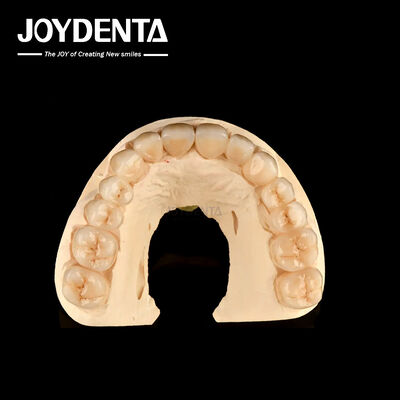 High Resistance To Corrosion Full Zirconia The Preferred Material for White Dental Restorations