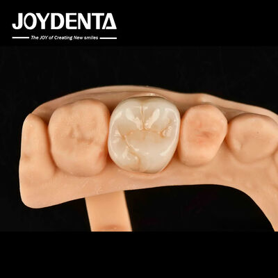 High Wear Resistance Dental Full Zirconia High Strength Full Contour Zirconia Bridge