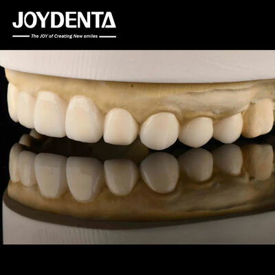 Dental Biomimetic Aesthetic Diagnostic  Wax-Up Of Veneers