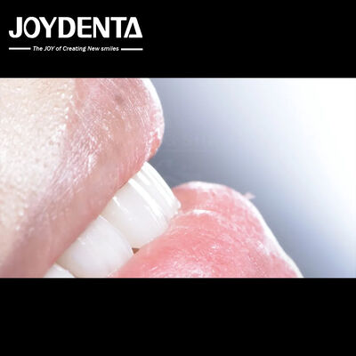 Long Lasting Dental Composite Veneer Good Biocompatibility No Drop Off porcelain veneers