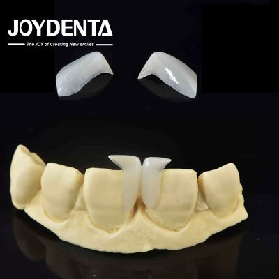 Customizable Smooth Micro Thin Veneers Long Lasting Natural Looking Veneers