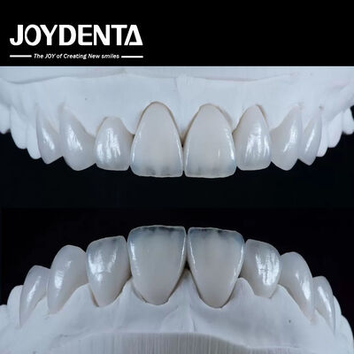 Natural Looking Emax Porcelain Veneer Comfortable Fit Ultra Thin Emax Veneers