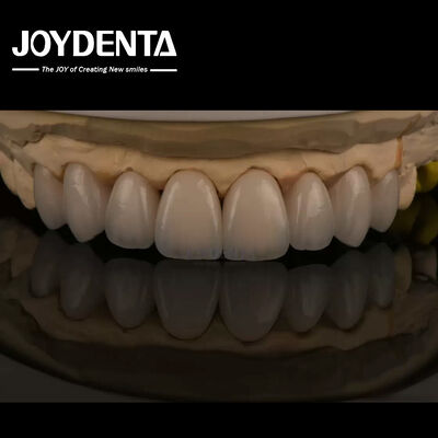 Feldspathic Natural Looking Cosmetic Veneers Precise Fit Highly Translucent
