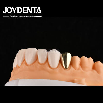 Ultra Thin IPS Emax Press Veneers Cosmetic Teeth Veneers For Anterior Posterior Restorations