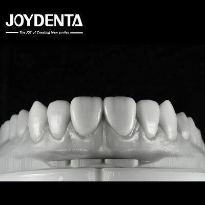 Natural Color Dental Wax Up Versatile Solution for Single or Multiple Teeth Restoration