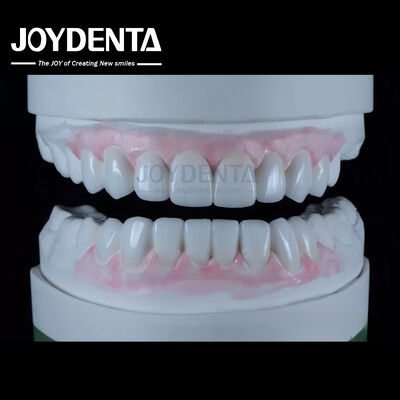 Highly Accurate Dental Restorations Wax Up In Dentistry 1-2mm Thickness