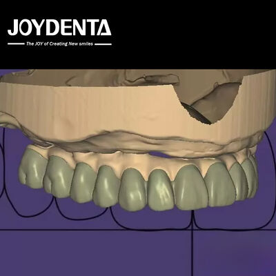 Individualized Design Digital Diagnostic Wax Up Lab Software Seamless Integration